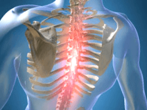 Повтаряща се или постоянна болезнена болка при остеохондроза на гръдния кош