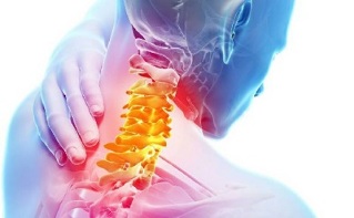 симптоми на остеохондроза на шийните прешлени